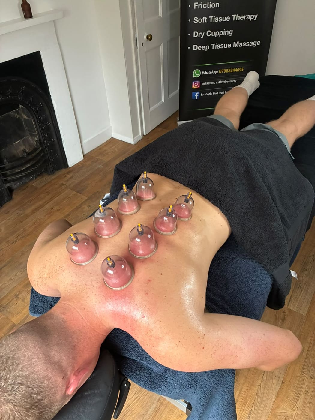 Shoulder cupping