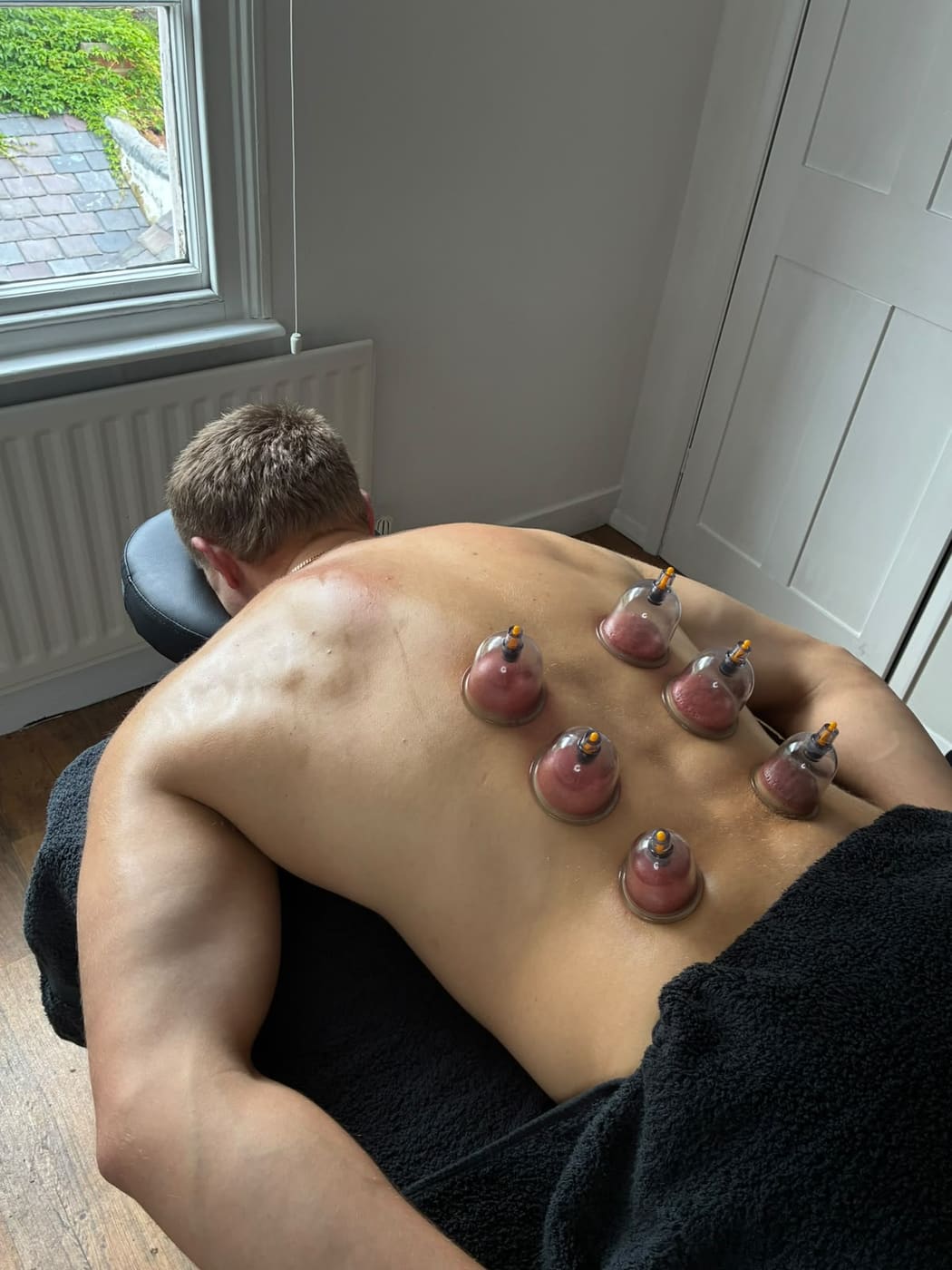 Cupping Therapy at Next Level Sports Recovery