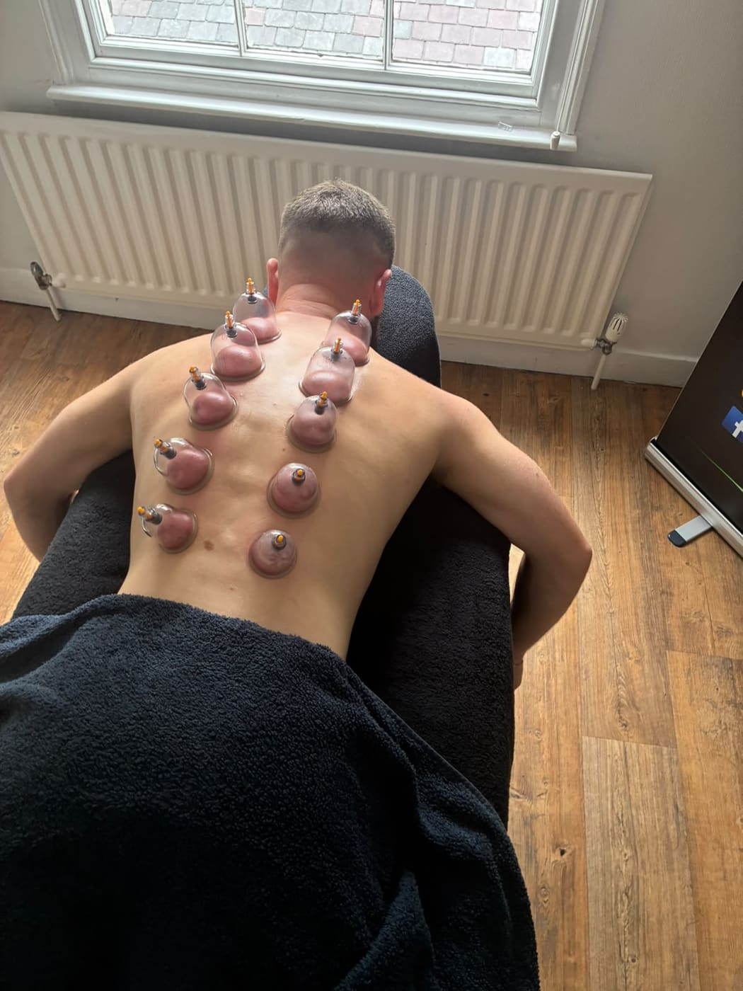 Dry cupping along both sides of the spine